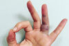 Признаци и симптоми на засрещнат пръст