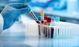 Пик на COVID-19 у нас е имало между 20 и 26 април