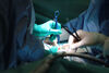 ВМА с нова апаратура за щадяща чернодробна хирургия