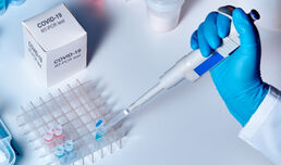 МБАЛ „Д-р Атанас Дафовски“АД извършва PCR тестове за COVID-19 срещу заплащане