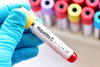 Съдът спря новите изисквания на НЗОК за диагностика на хепатит С