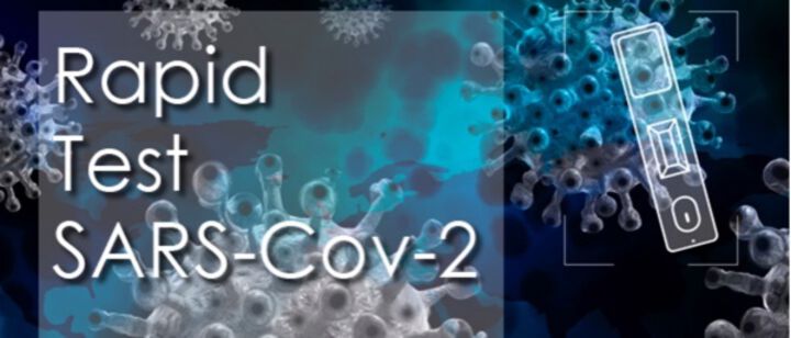 Как бързите диагностични тестове за Ковид-19 и причинители на други респираторни болести ще помогнат на Общопрактикуващите лекари в тежката епидемична обстановка и очаквано добавената Грипна емидемия?
