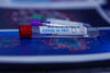 Бързите антигенни тестове се приравняват на PCR