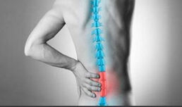 Митовете и реалността за проблемите с гърба – болка, причина, лечение
