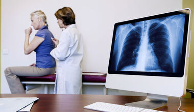 Д-р Захаринка Вълканова, ОПЛ: Туморни маркери за рак на белия дроб да се назначават от личните лекари