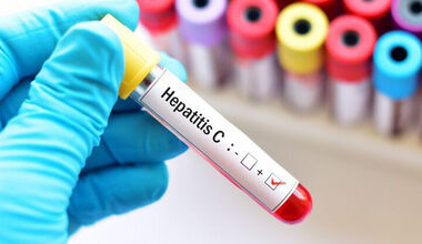 Безплатно тестване за хепатит С в УМБАЛ „Св. Иван Рилски” до края на август