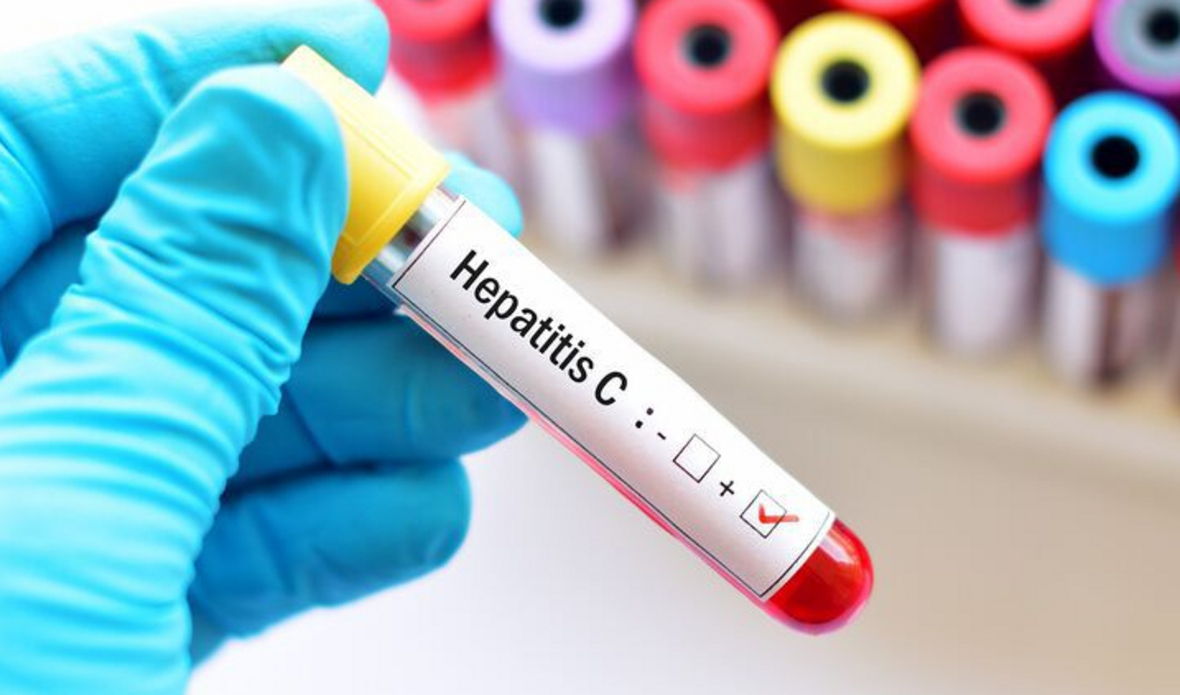 Безплатно тестване за хепатит С в УМБАЛ „Св. Иван Рилски” до края на август
