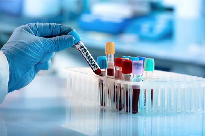 Лабораторията по клинична имунология приема и кръвни проби по куриер