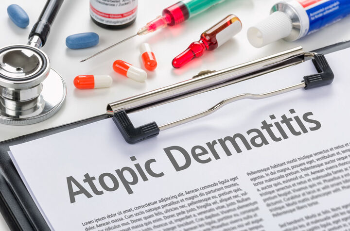 ЕК одобри нова терапия за лечение на атопичен дерматит при възрастни и деца над 12 г.