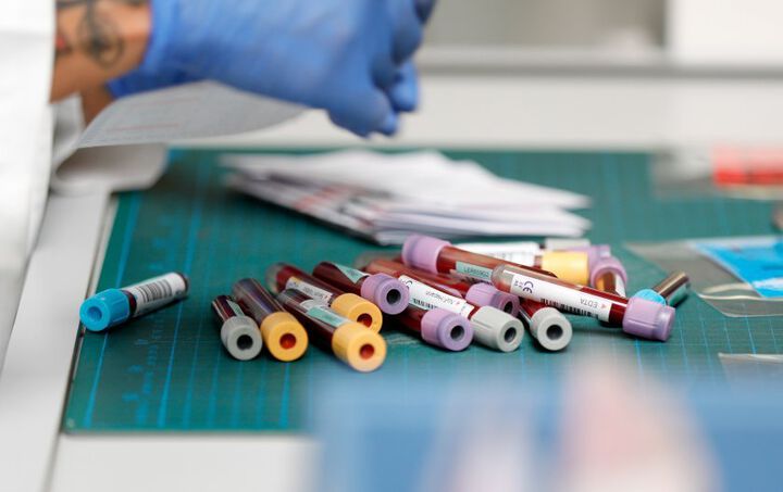 Проект на МЗ: От догодина НЗОК ще плаща тестовете за антитела