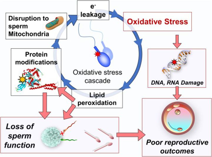 Glutathione content and glutathione peroxidase activity of sperm in males with unexplained infertility