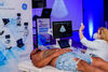 3D принт на биещо сърце е сред най-новите технологии за точна оперативна прогноза