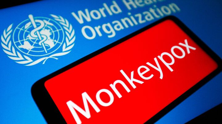 СЗО: Сериозна заплаха е наличието на огнища на маймунска шарка в над 50 страни