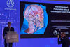 3D фотореалистичен атлас по неврохирургия и невроанатомия вече е реалност