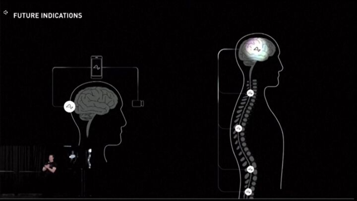 Мъск: До шест месеца започваме тестове на мозъчен чип върху хора