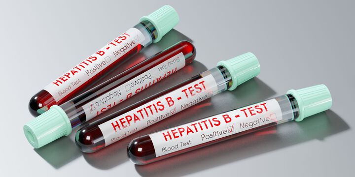Какво да правим, ако имаме пациент с положителен тест за хепатит