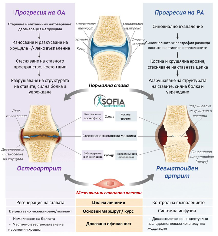 Прогресия на ревматоиден артрит (РА) и остеоартрит (ОА)