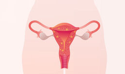 Жълто тяло и аденомиоза - важни фактори за репродуктивното здраве на жените
