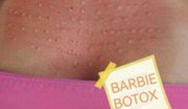 Барби botox