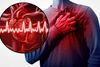Близо половината хора не разпознават симптомите на инфаркта