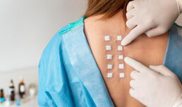 Безплатни прегледи и тестувания за кожни алергии в УМБАЛ Токуда