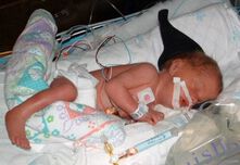 Д-р Борислава Чакърова: 16-дневно бебе е заразено с чревната инфекция гиардиаза!