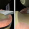 Модерна операция на менискус запазва движението на колянната става (ВИДЕО)