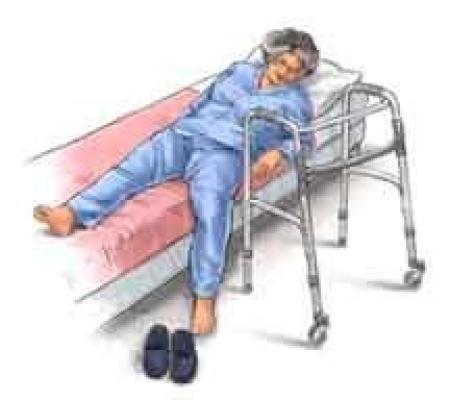 Операция на позвоночник как вставать. Кровать для больных с переломами. Кровать после эндопротезирования тазобедренного сустава. Кровать после операции на тазобедренном суставе. Кровать для больных с переломом позвоночника.