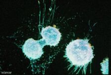 Изследване на циркулиращи туморни клетки при пациенти с рак на главата и шията 