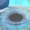 Лазерна корекция на зрението - какво да очакваме преди, по време и след процедурата