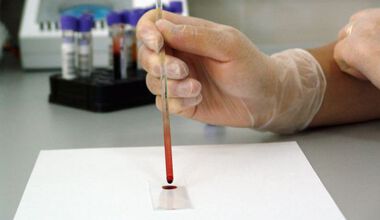 Кръвен тест определя биологичната възраст
