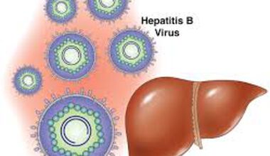 Бебе с остър вирусен хепатит В