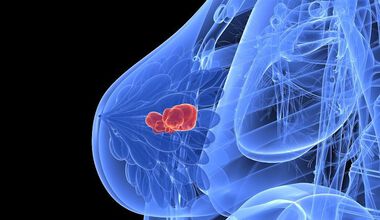 Прогнози при наличие на свободно циркулиращи туморни клетки две години след лечение на рак на гърдата