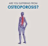 Броят на мъжете във Варна, страдащи от остеопороза расте
