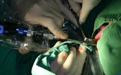 В АГ болницата във Варна безкръвните операции са рутинна практика