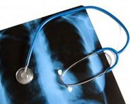 УМБАЛ „Свети Георги“ организира  скрининг за риска от туберкулоза 