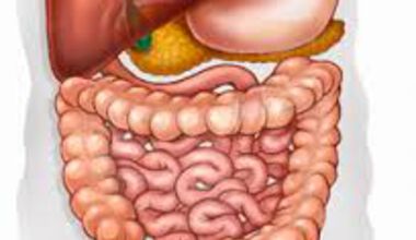 При неясни чревни симптоми и анемия прегледайте дебелото черво