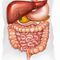 При неясни чревни симптоми и анемия прегледайте дебелото черво