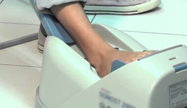 Майчин дом откри кабинет за измерване на костната плътност