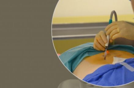 Нов метод за лечение на болката ще бъде представен в болница „Токуда“