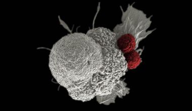 Имунотерапия: Може ли човешкото тяло да се обучи да пребори рака