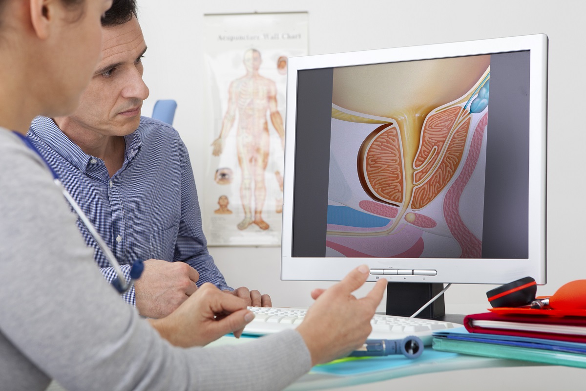 Терапията на увеличената простата трябва да бъде съобразена с индивидуалните особености на пациента