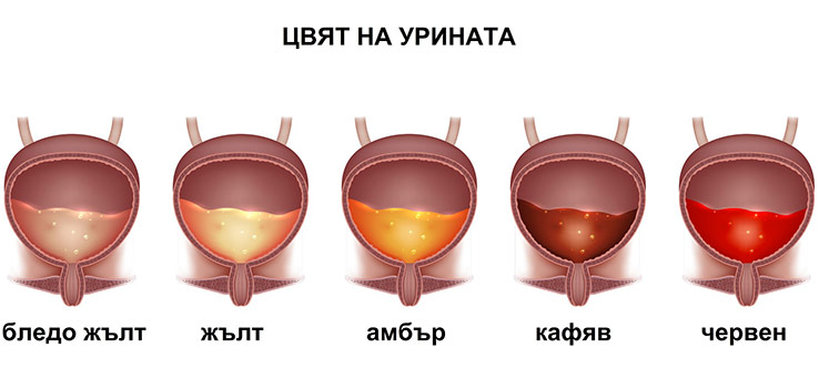 Какво означава кръв в урината? 