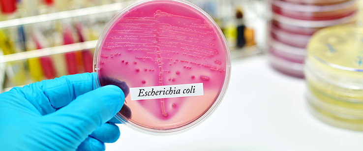 Ешерихия коли е една от двете бактерии водещи до уроинфекция и цистит