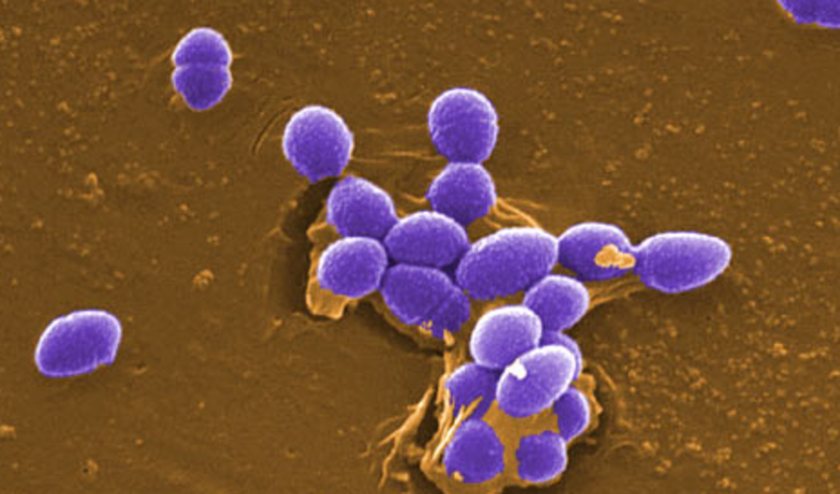Las bacterias intestinales consumen la droga de Parkinson Levodopa, a menudo con efectos secundarios dañinos