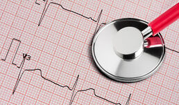 Women with common heart rhythm disorder have faster cognitive decline than men