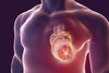 Anticoagulation shows no benefit after primary percutaneous coronary intervention