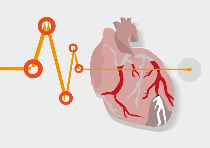 Cardiac injury among Covid-19 patients tied to higher risk of death