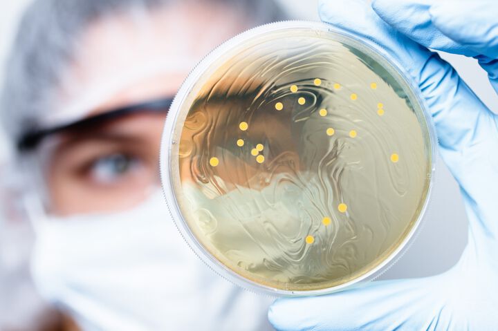 Characterization and determination of antibiotic susceptibility pattern of bacteria associated with untreated infected wound