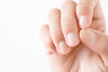 5 tips to improve nail psoriasis at home